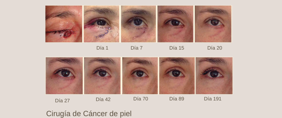 Efectividad total para cuidar tus cicatrices