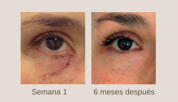 elimina tus cicatrices con Kahai oil 100% comprobado